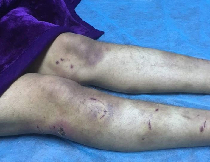 Seized Misratan journalist savaged by dog: report