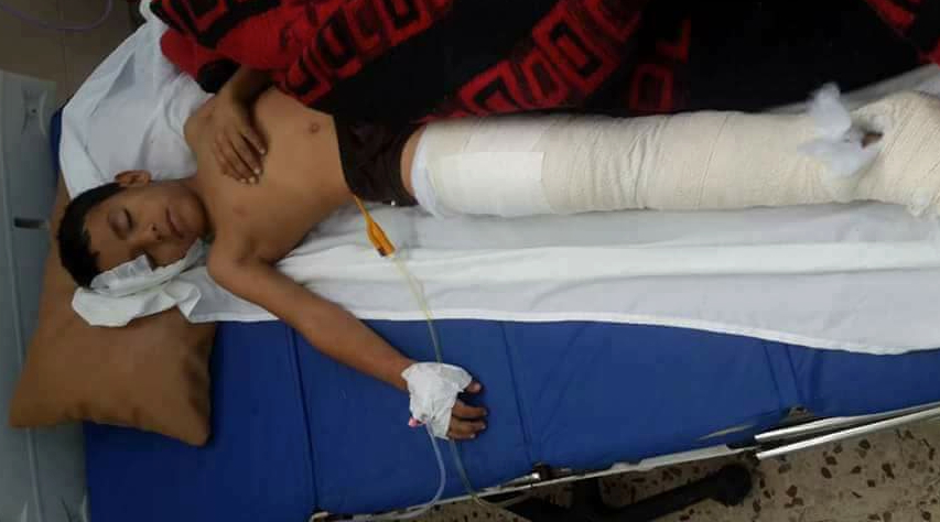 One of the injured students with a shattered leg (Photo: social media)