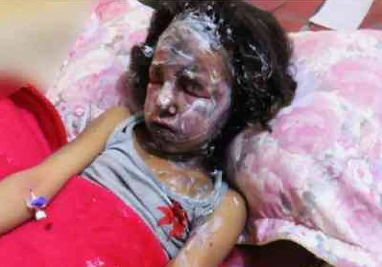 But no grin from this girl who reportedly escaped Ganfouda with her family (Photo::socia media)